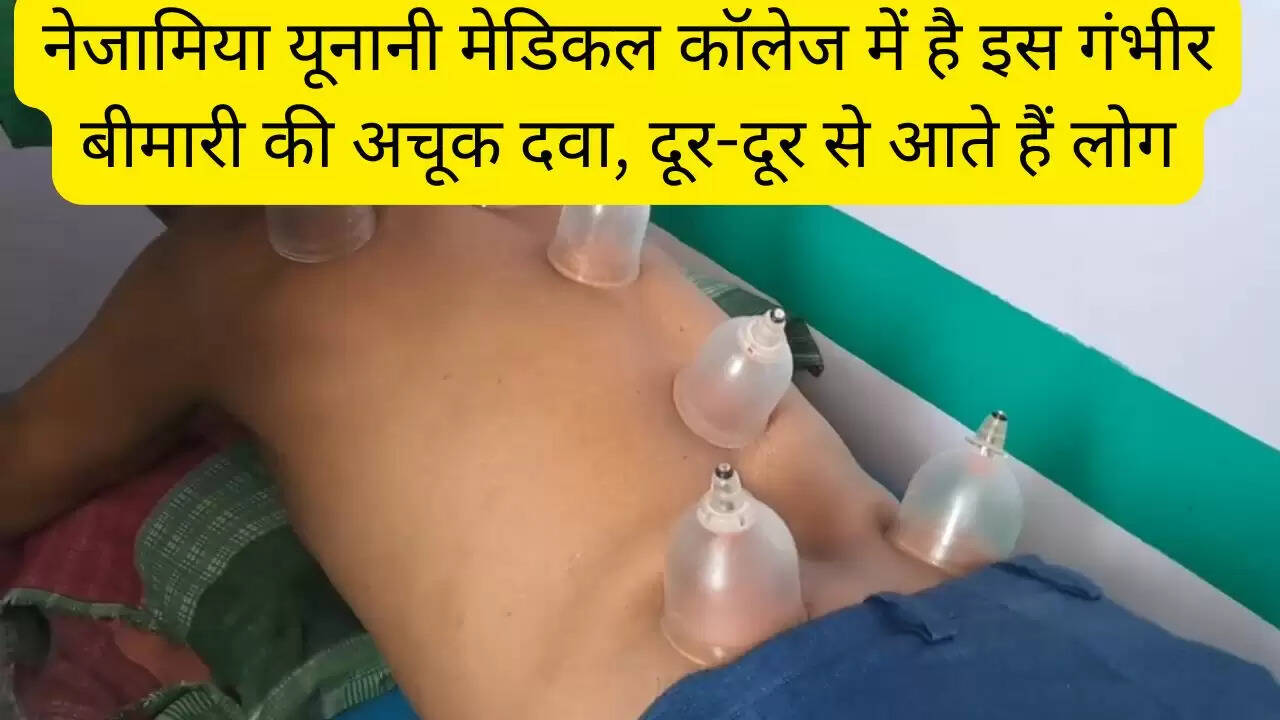 नेजामिया यूनानी मेडिकल कॉलेज में है इस गंभीर बीमारी की अचूक दवा, दूर-दूर से आते हैं लोग